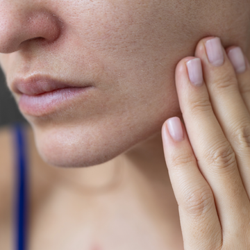Close-up of a person touching their cheek near the mouth, showing dry or irritated skin.