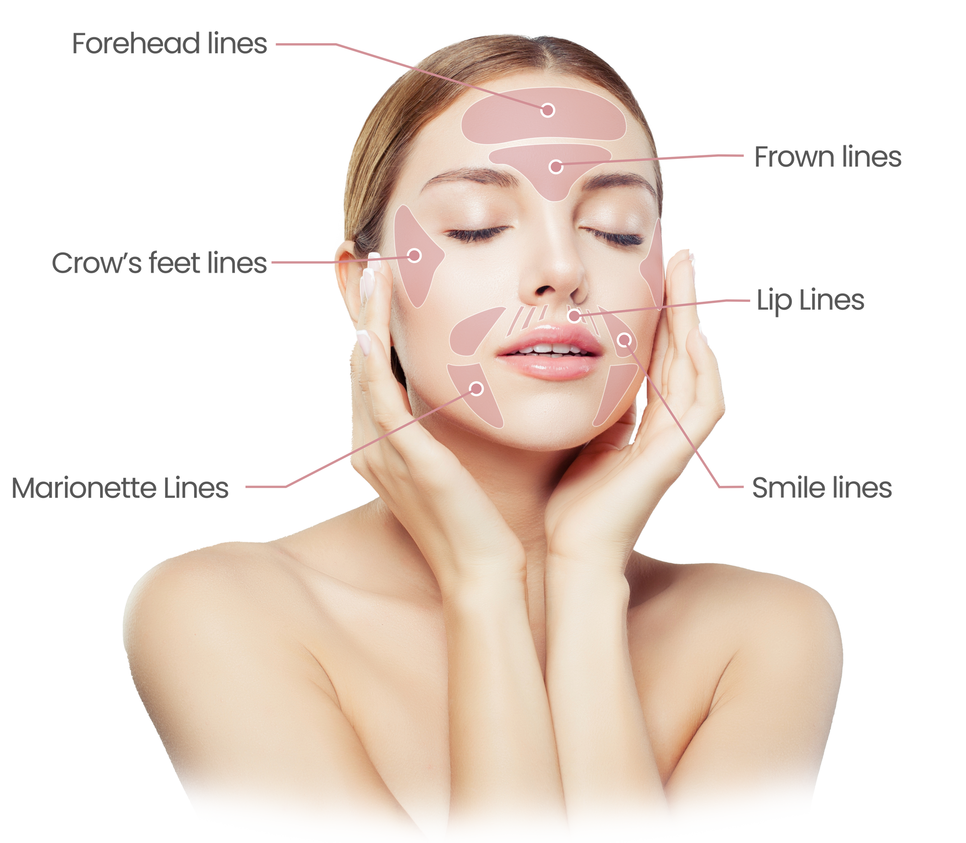 fine lines common problem areas
