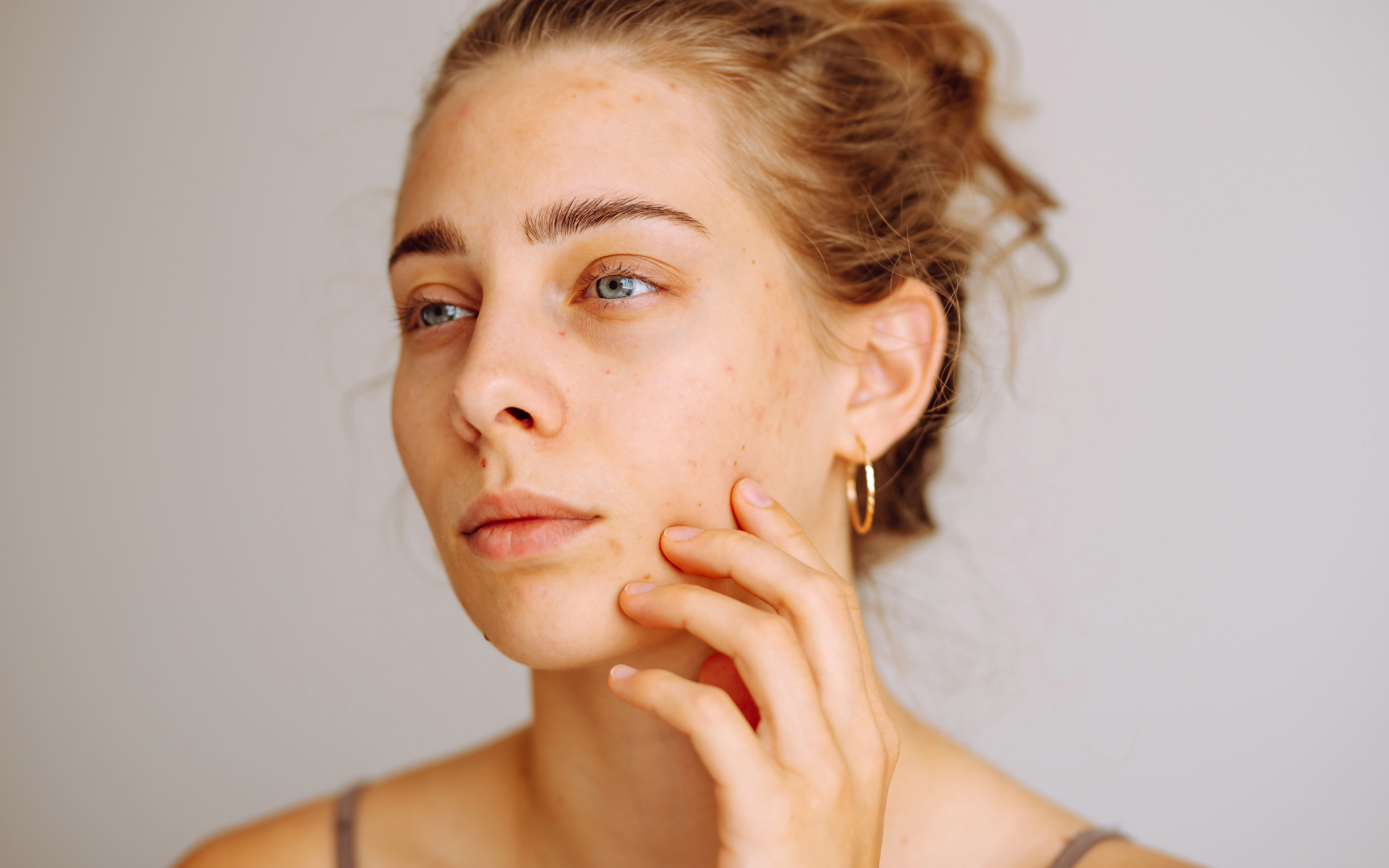 Close-up of client's skin during a consultation at Immortal Cosmedical's cosmetic clinic in Bowral