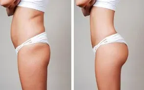 Cosmetic Post-Operative Care Sydney Packages