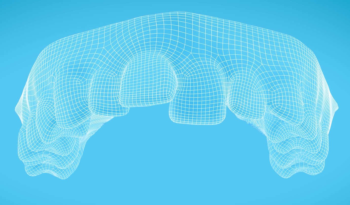 Invisalign