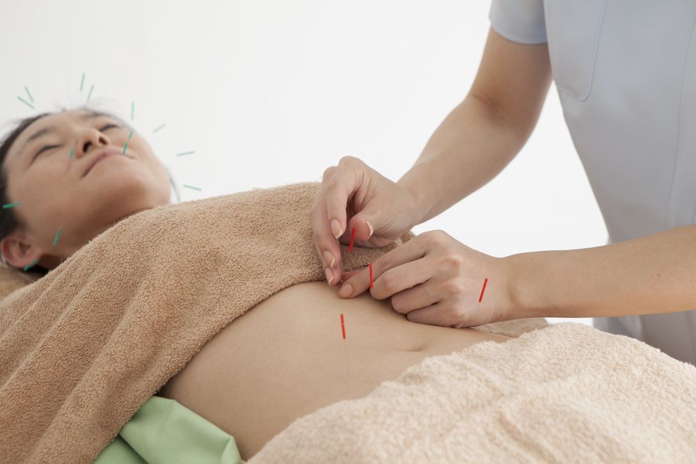Acupuncture treatment on a patient lying on a bed, with needles placed in the abdomen and face