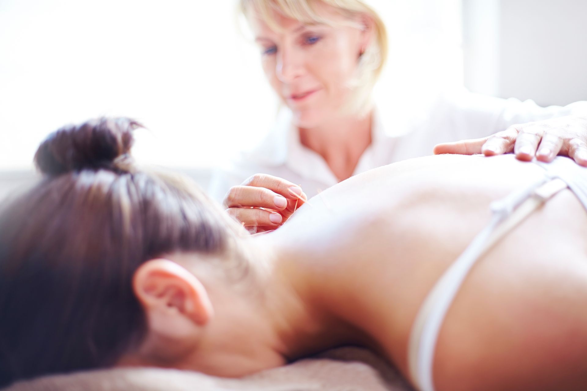 acupuncturist using acupuncture on a young woman to help improve the success rate of IVF