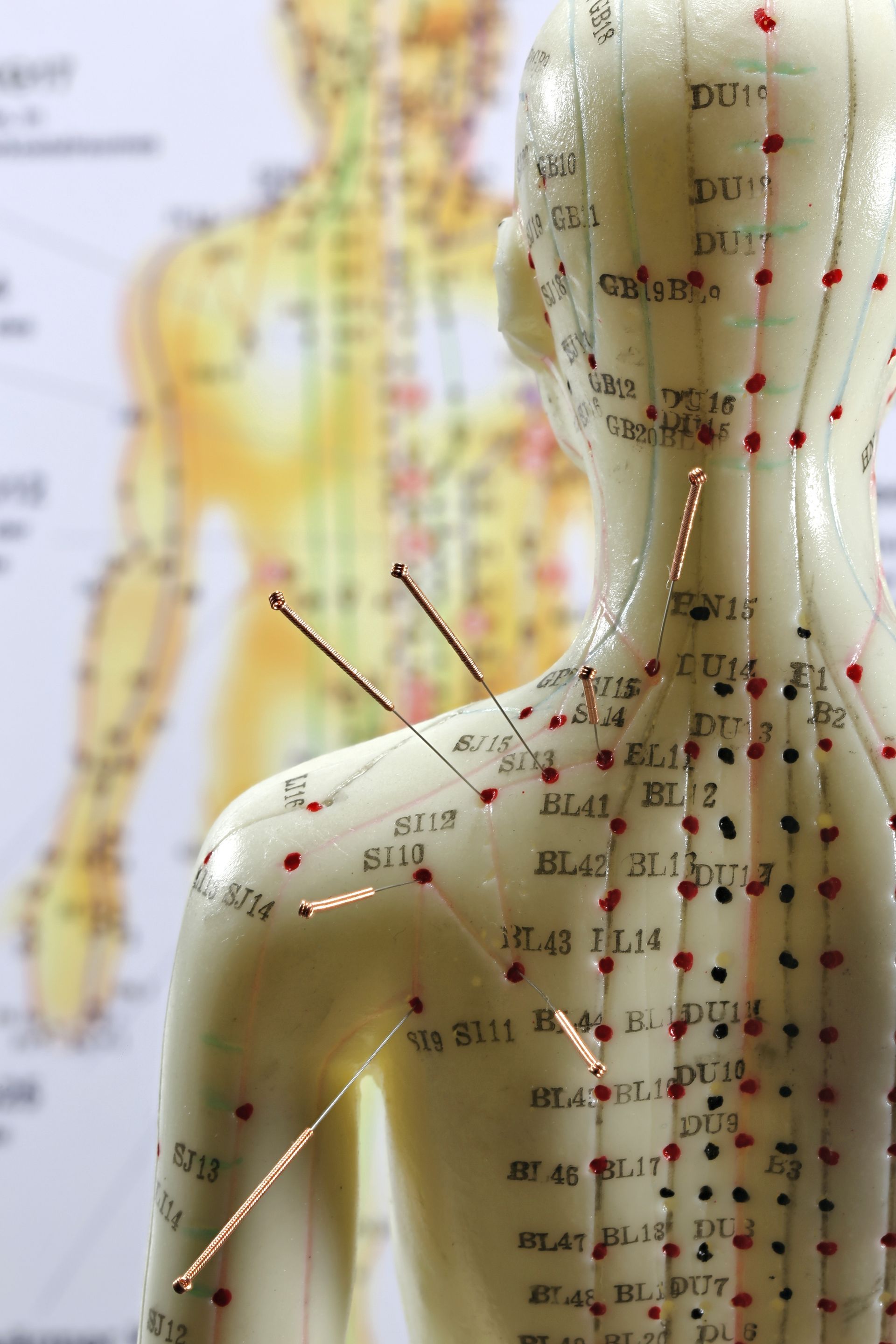 A human model with acupuncture points labeled for acupuncture for fertility benefits