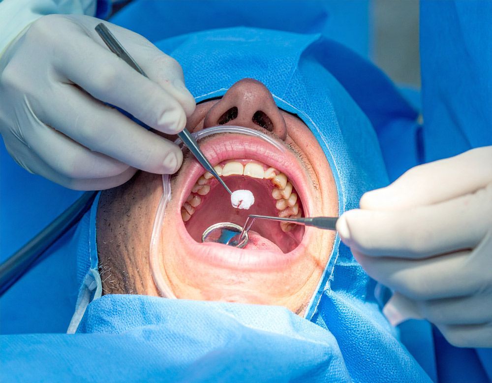 Dentist performing a dental procedure on a patient's open mouth; medical tools visible, surgical setting.
