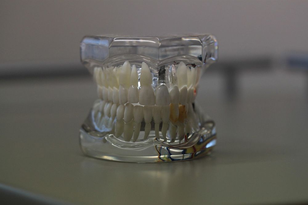 Dental Implant Meridian Idaho
