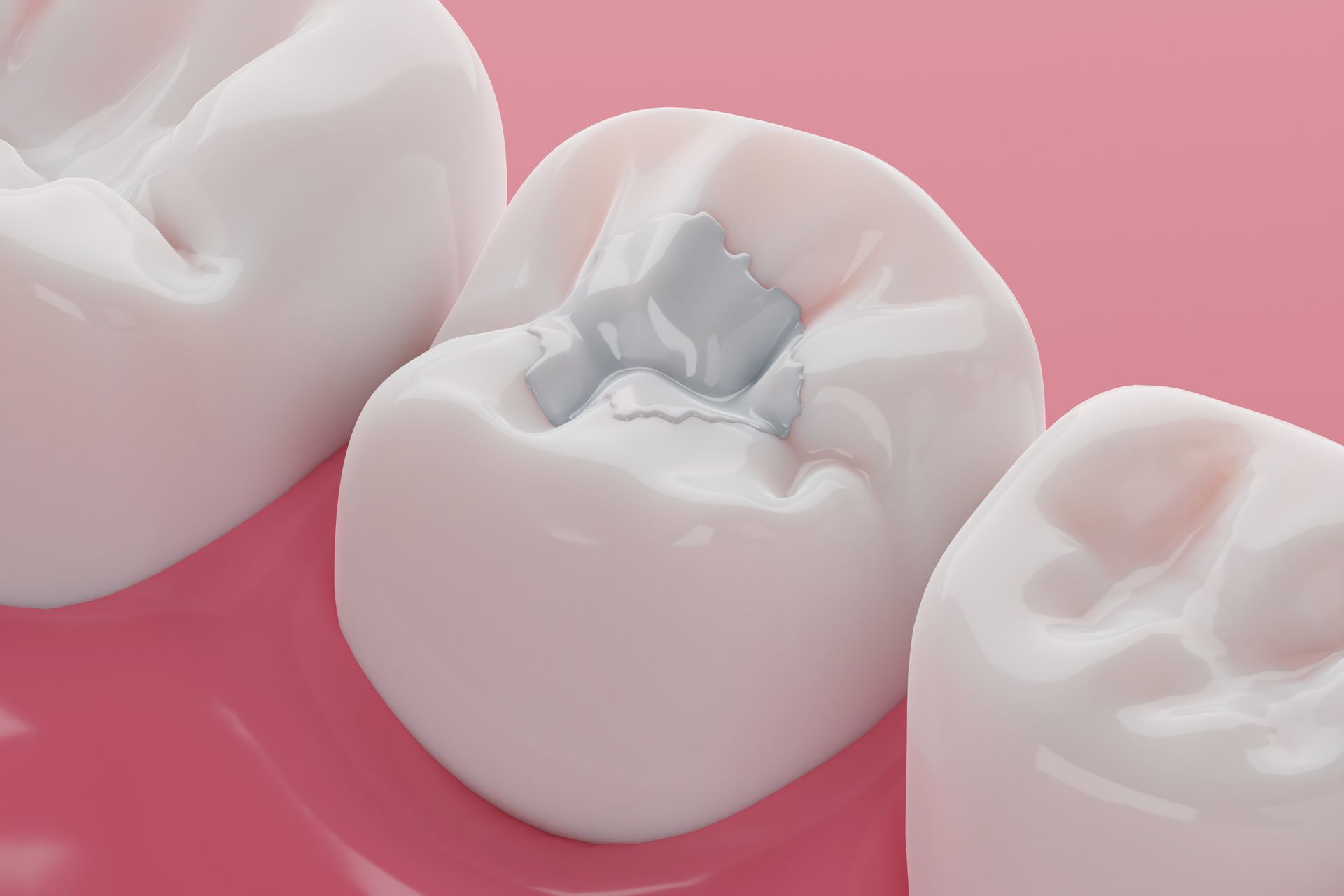 Silverstone Family Dental Meridian, ID