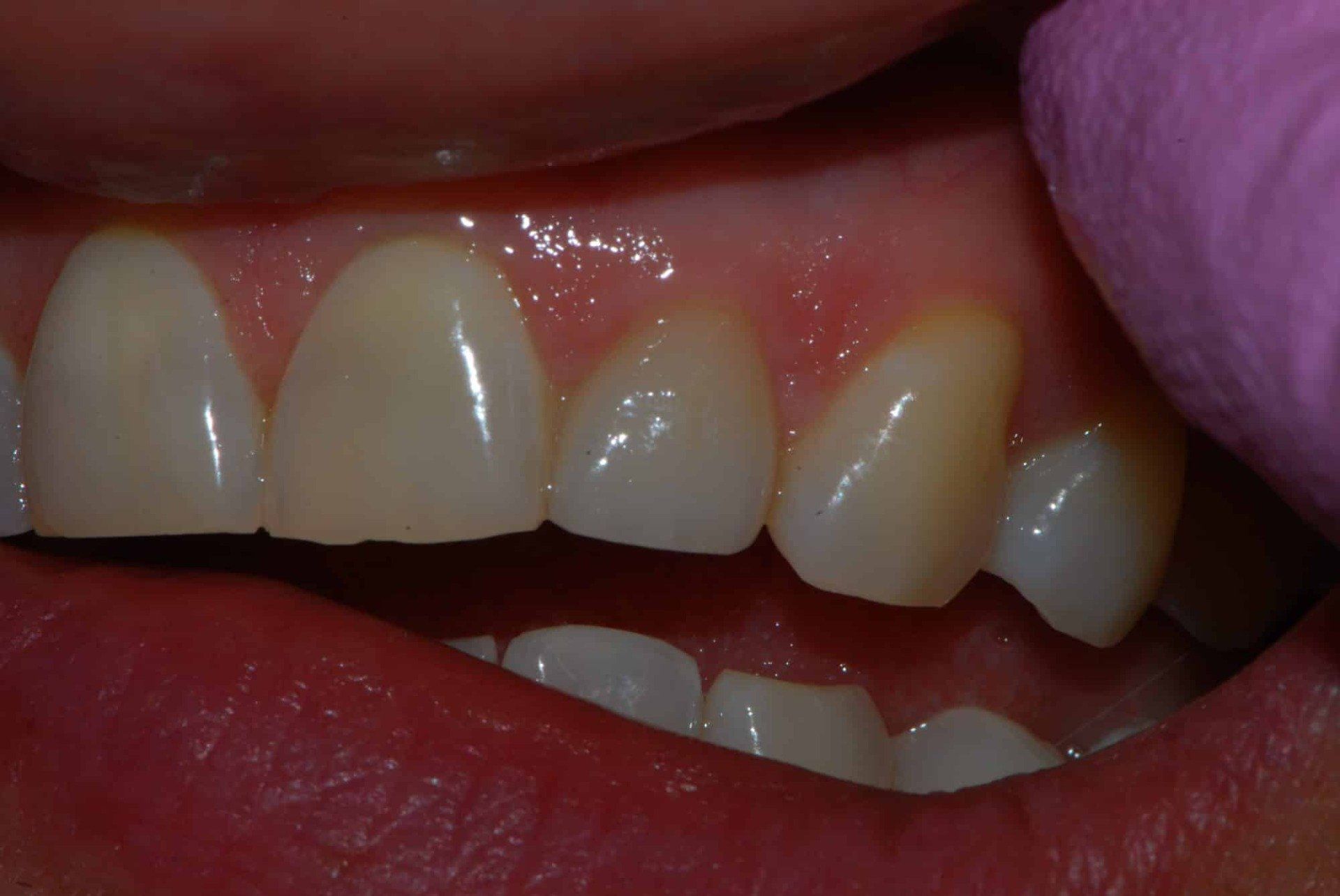 Silverstone Family Dental Meridian, ID