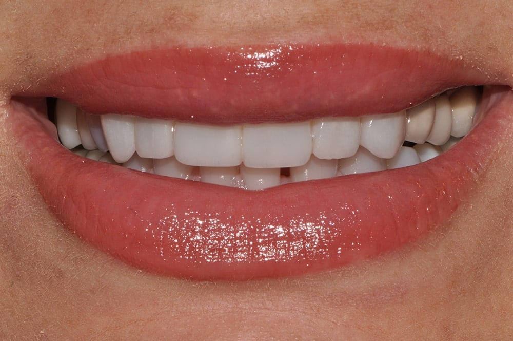 Silverstone Family Dental Meridian, ID
