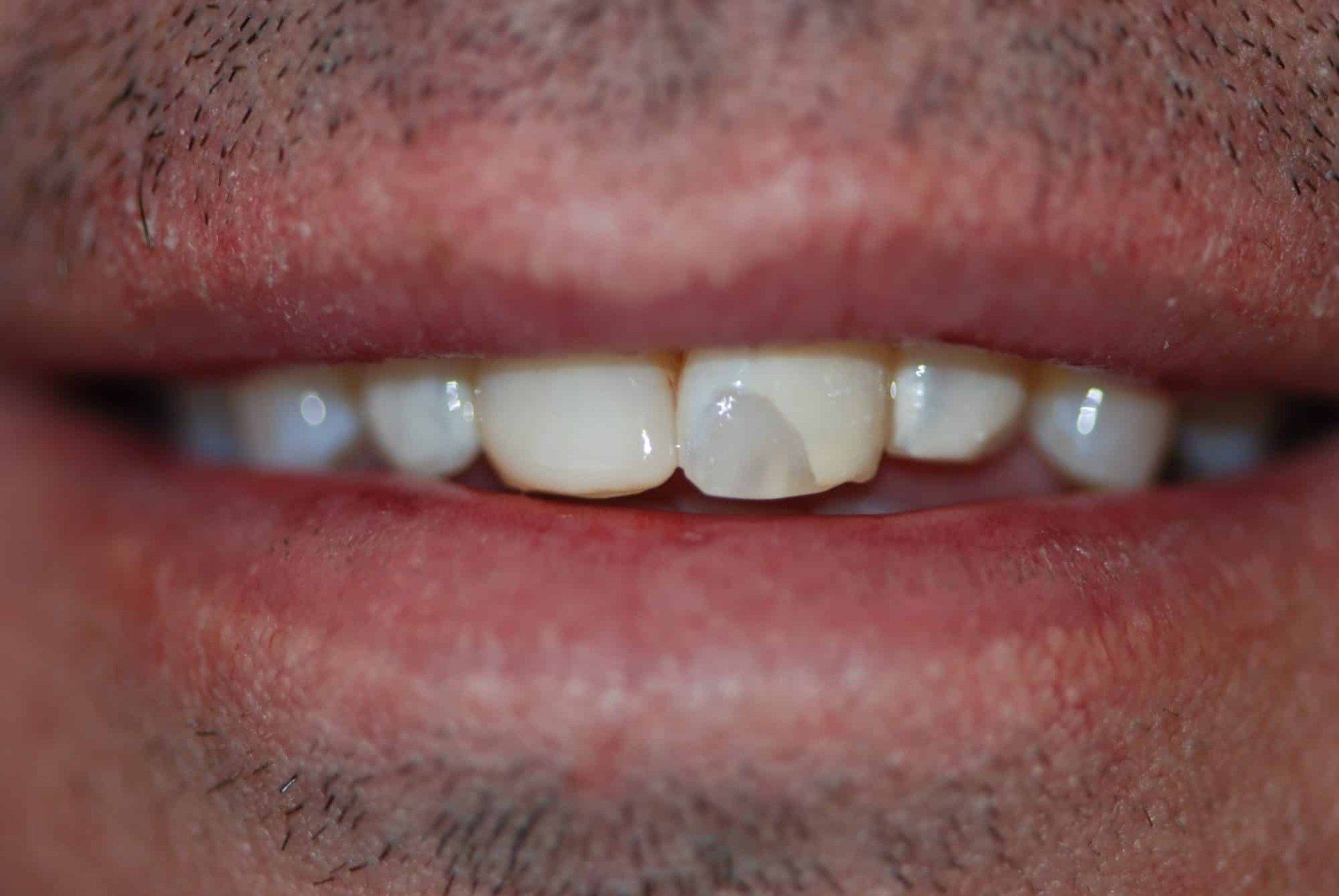 Silverstone Family Dental Meridian, ID