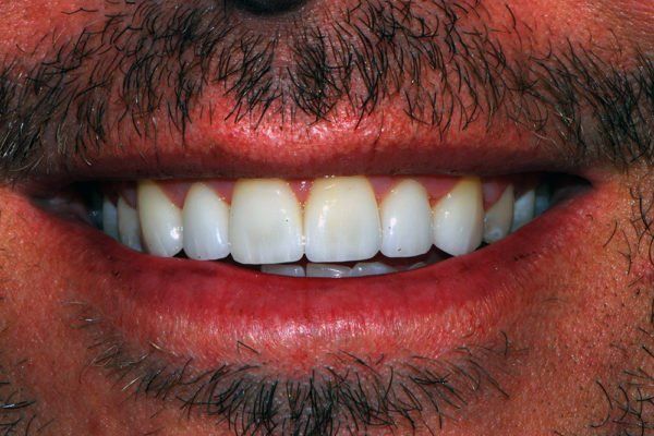 Silverstone Family Dental Meridian, ID