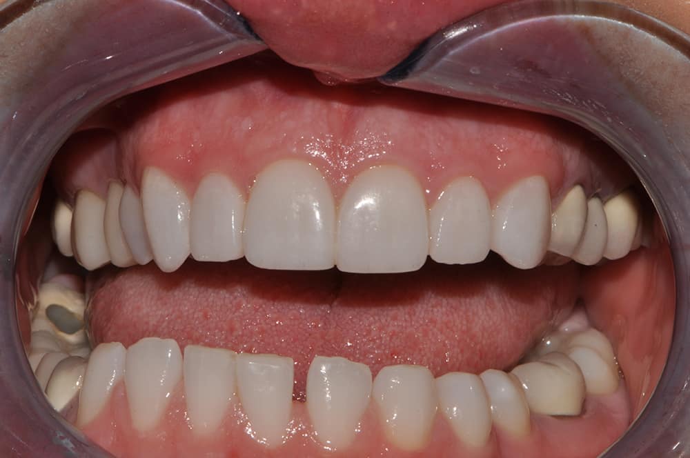 Silverstone Family Dental Meridian, ID