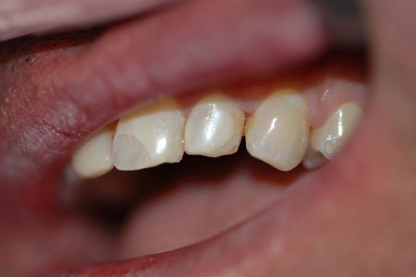 Silverstone Family Dental Meridian, ID