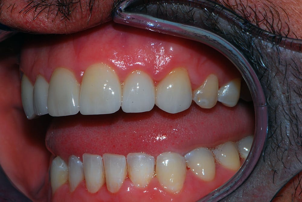 Silverstone Family Dental Meridian, ID