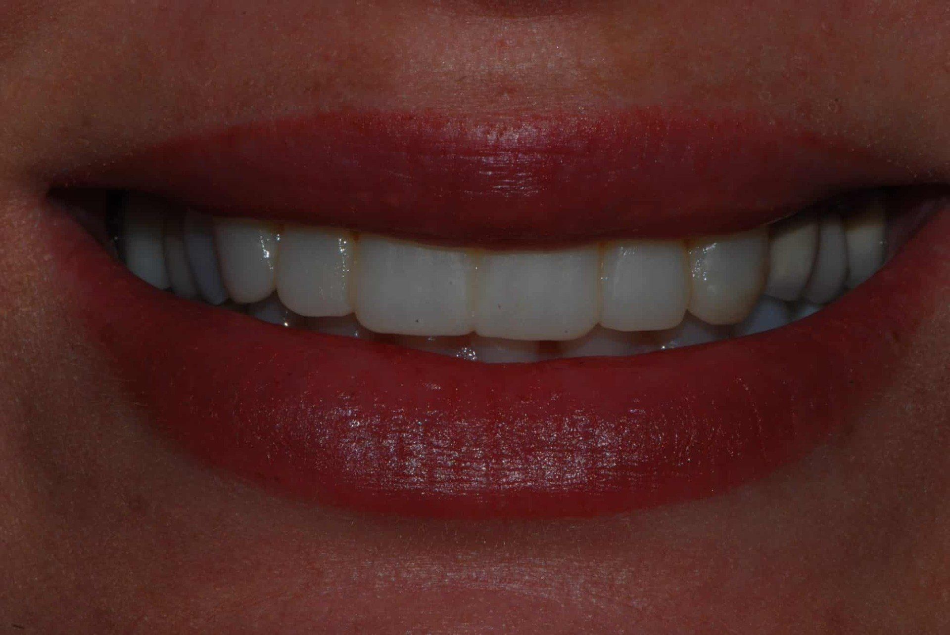 Silverstone Family Dental Meridian, ID