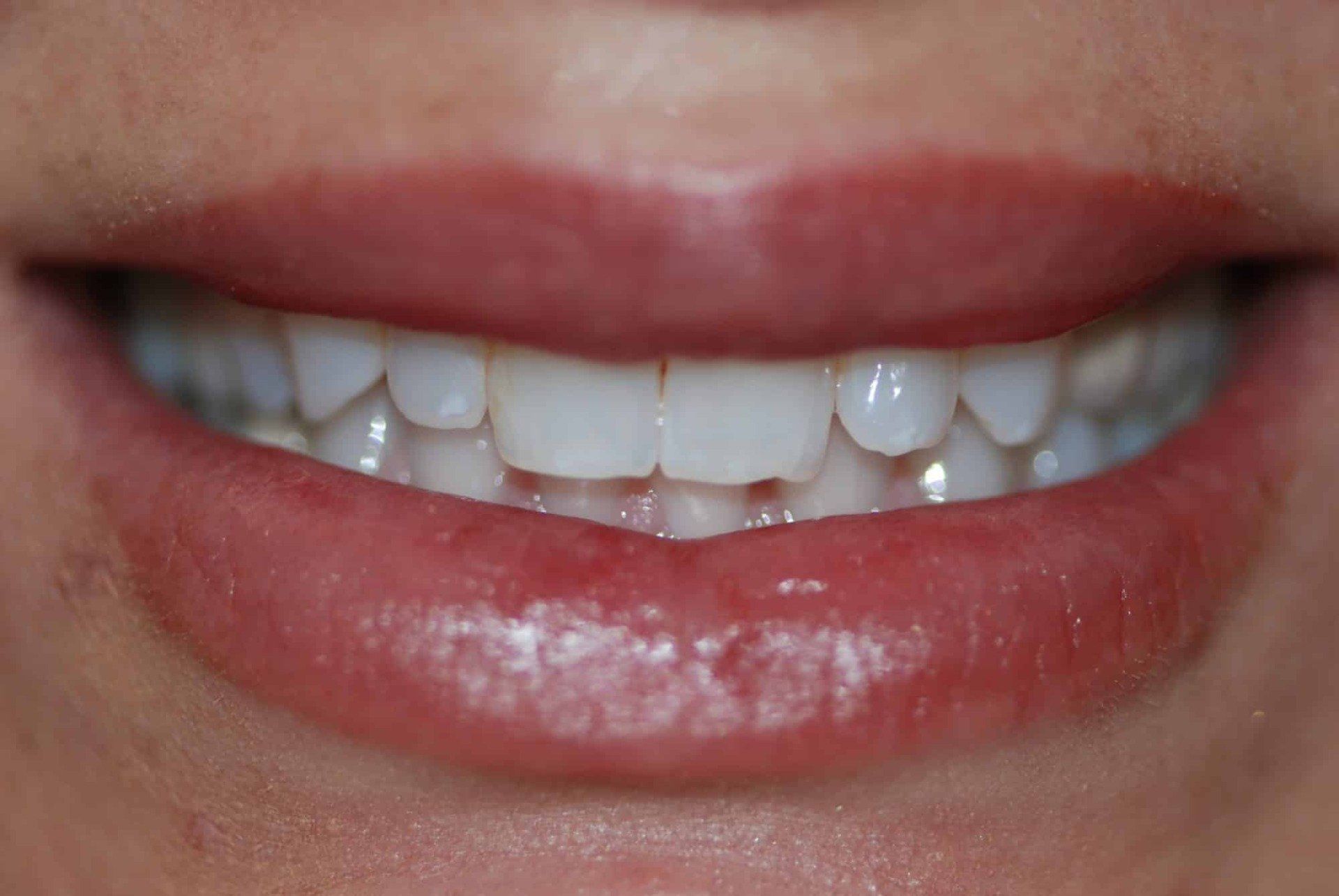 Silverstone Family Dental Meridian, ID