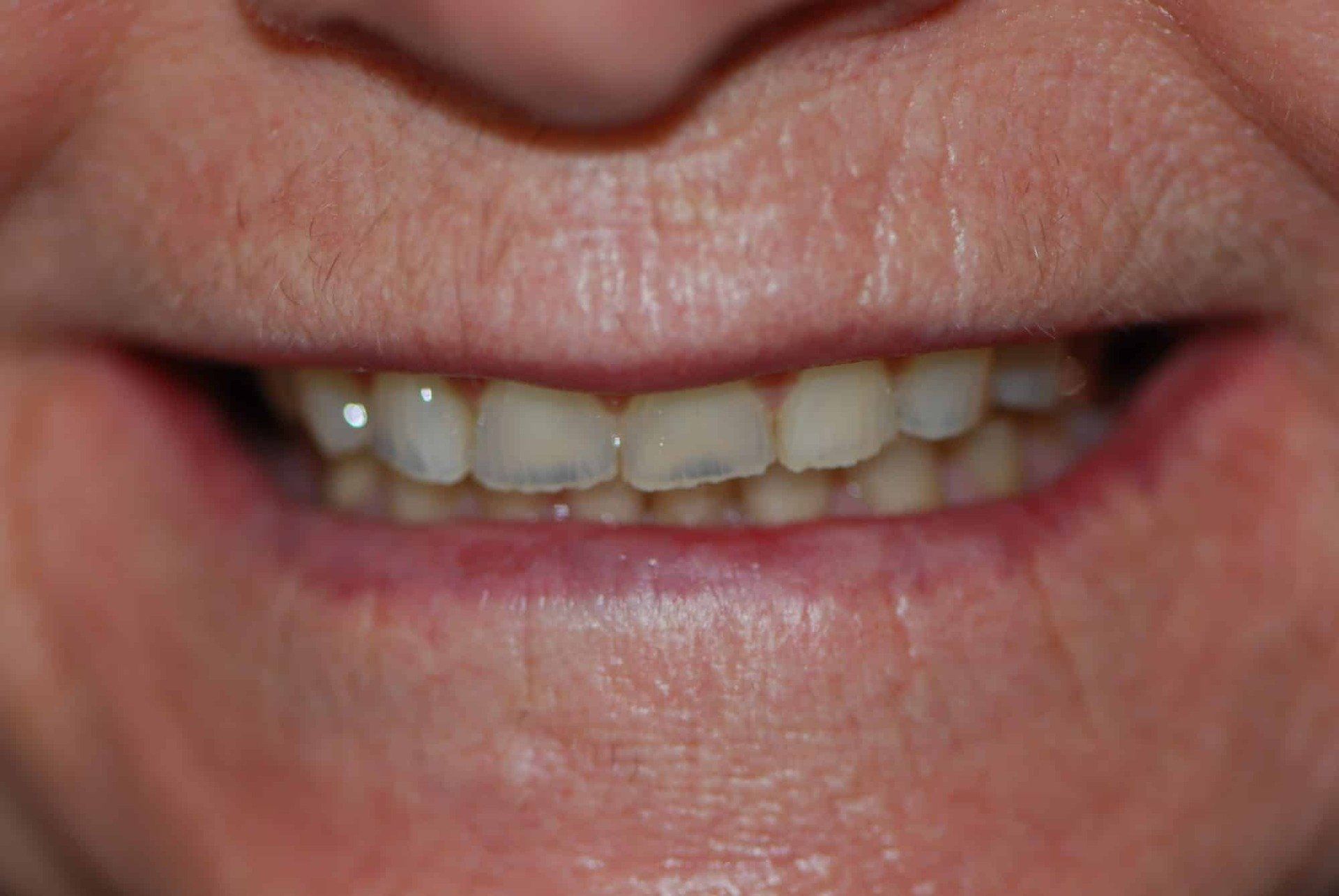 Silverstone Family Dental Meridian, ID