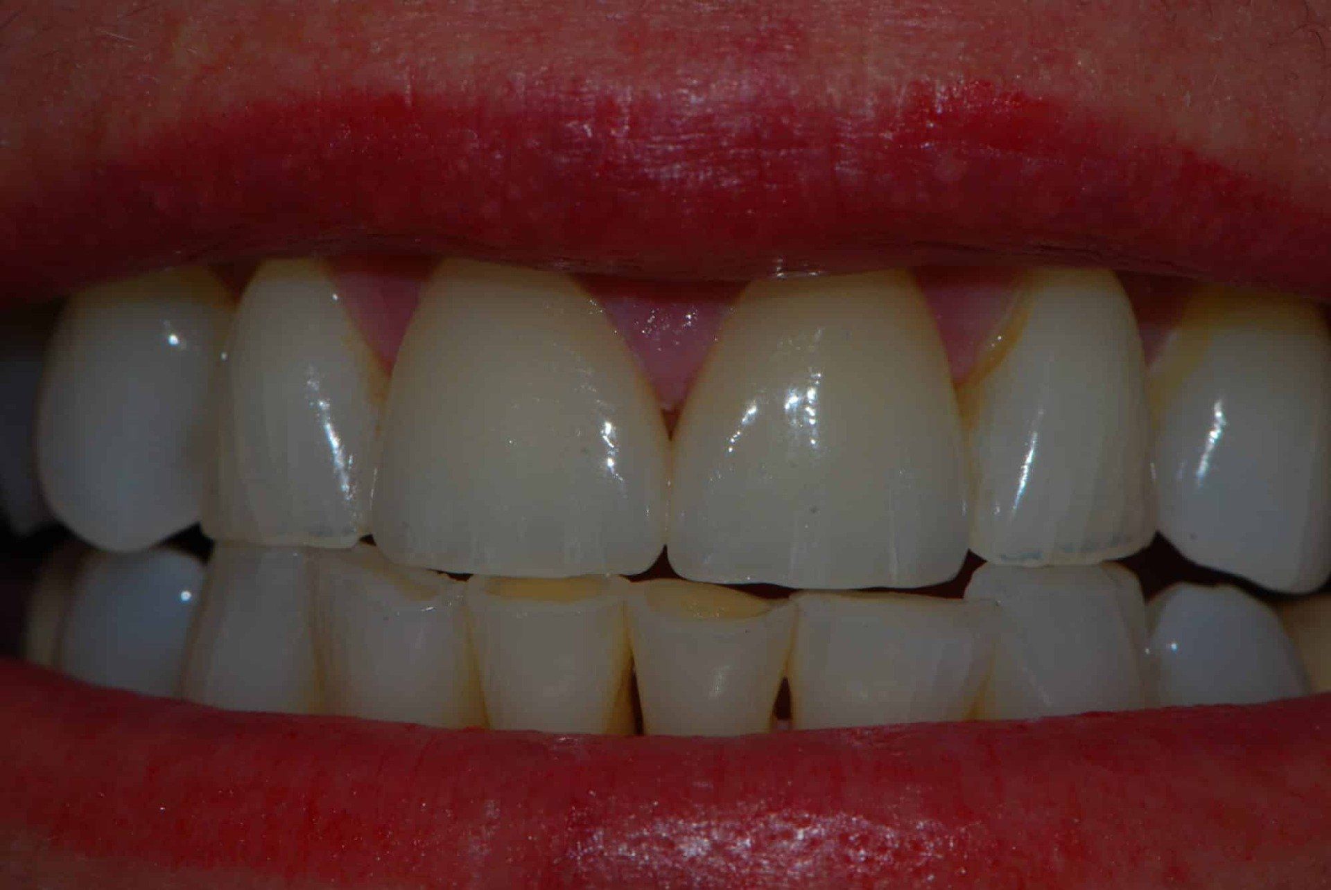 Silverstone Family Dental Meridian, ID