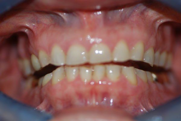 Silverstone Family Dental Meridian, ID
