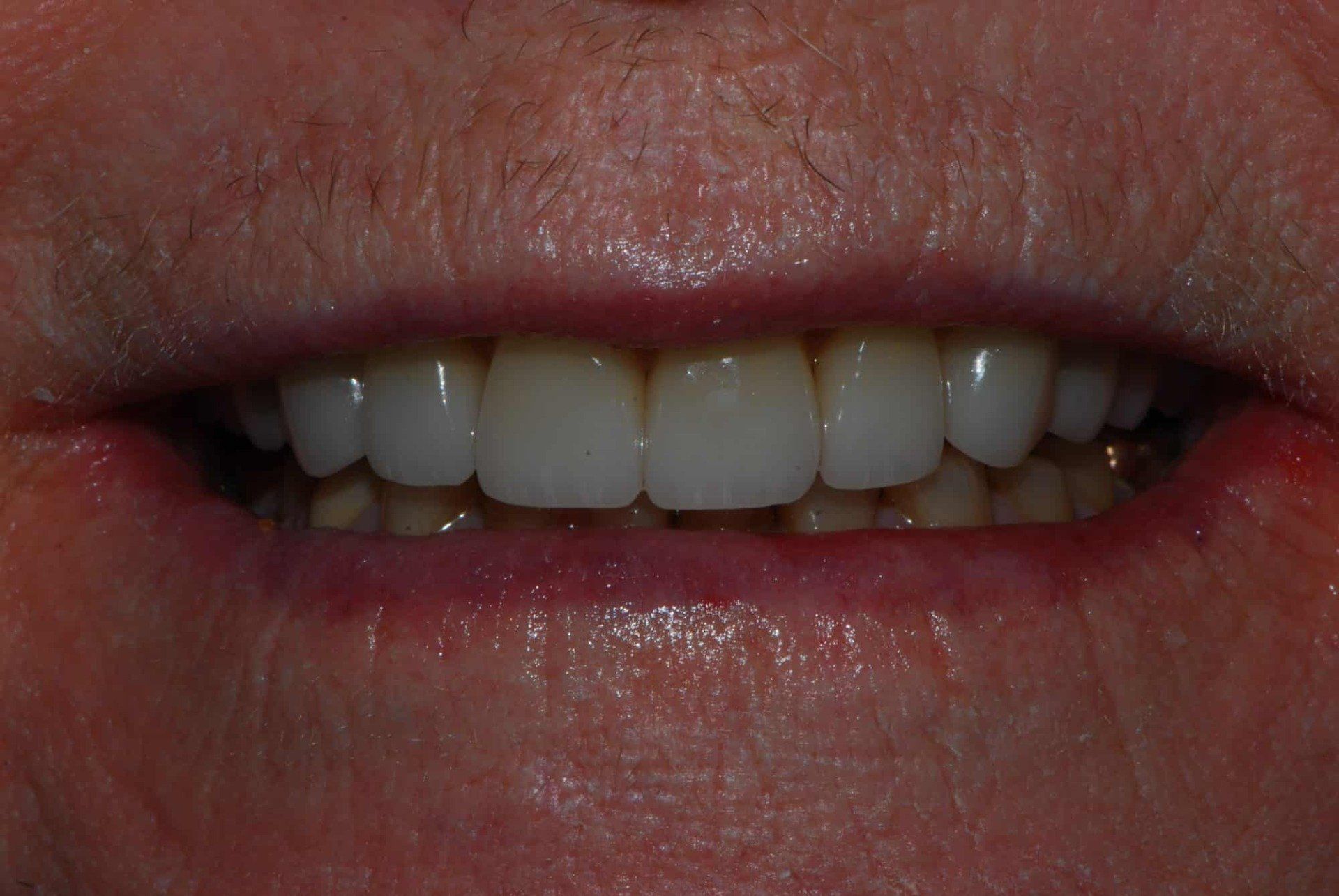 Silverstone Family Dental Meridian, ID