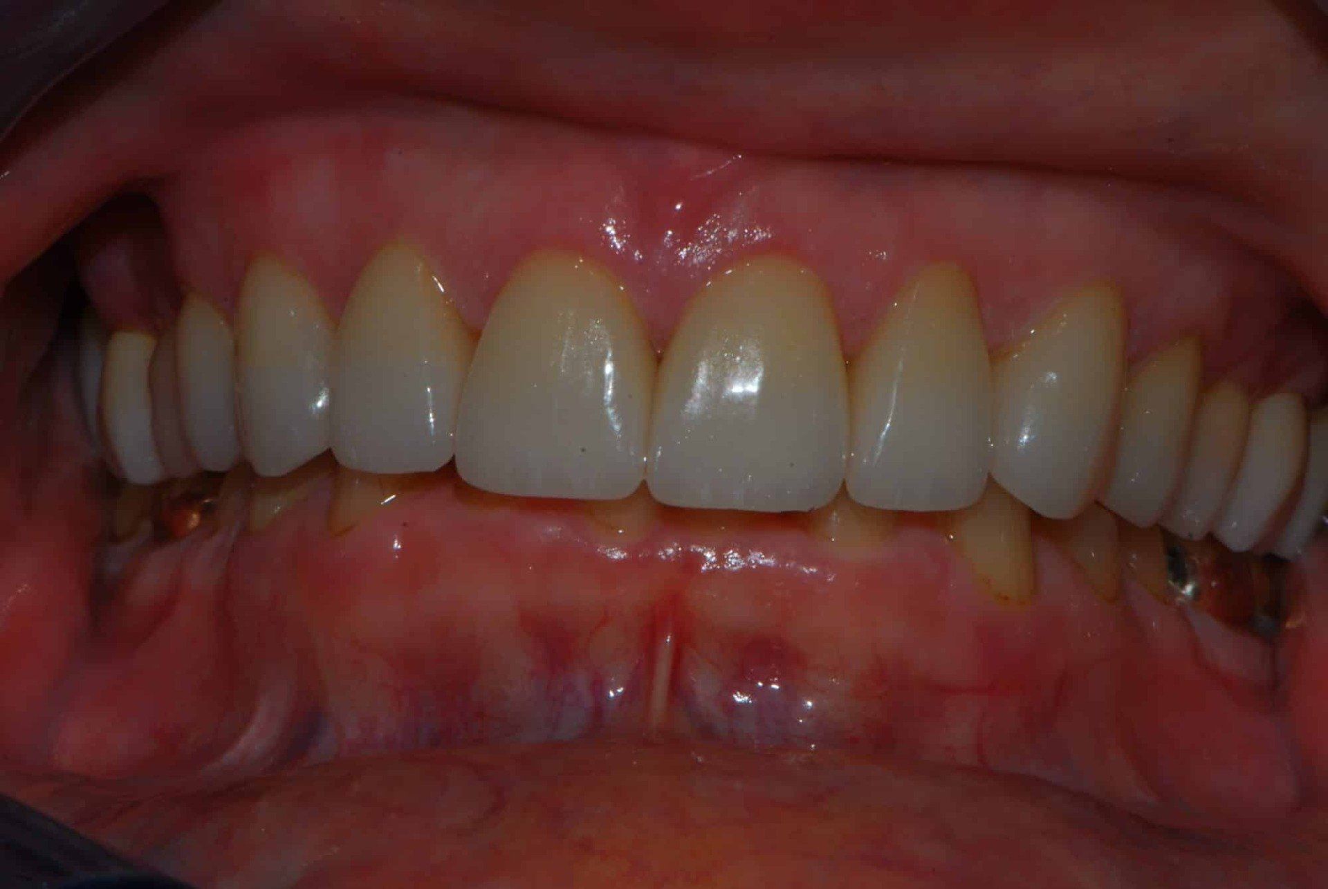 Silverstone Family Dental Meridian, ID