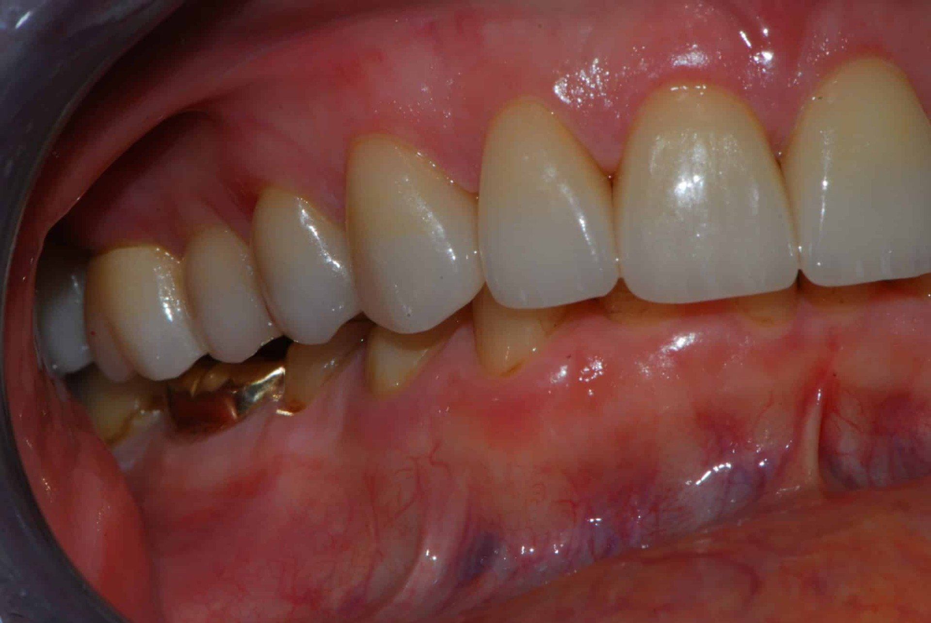 Silverstone Family Dental Meridian, ID