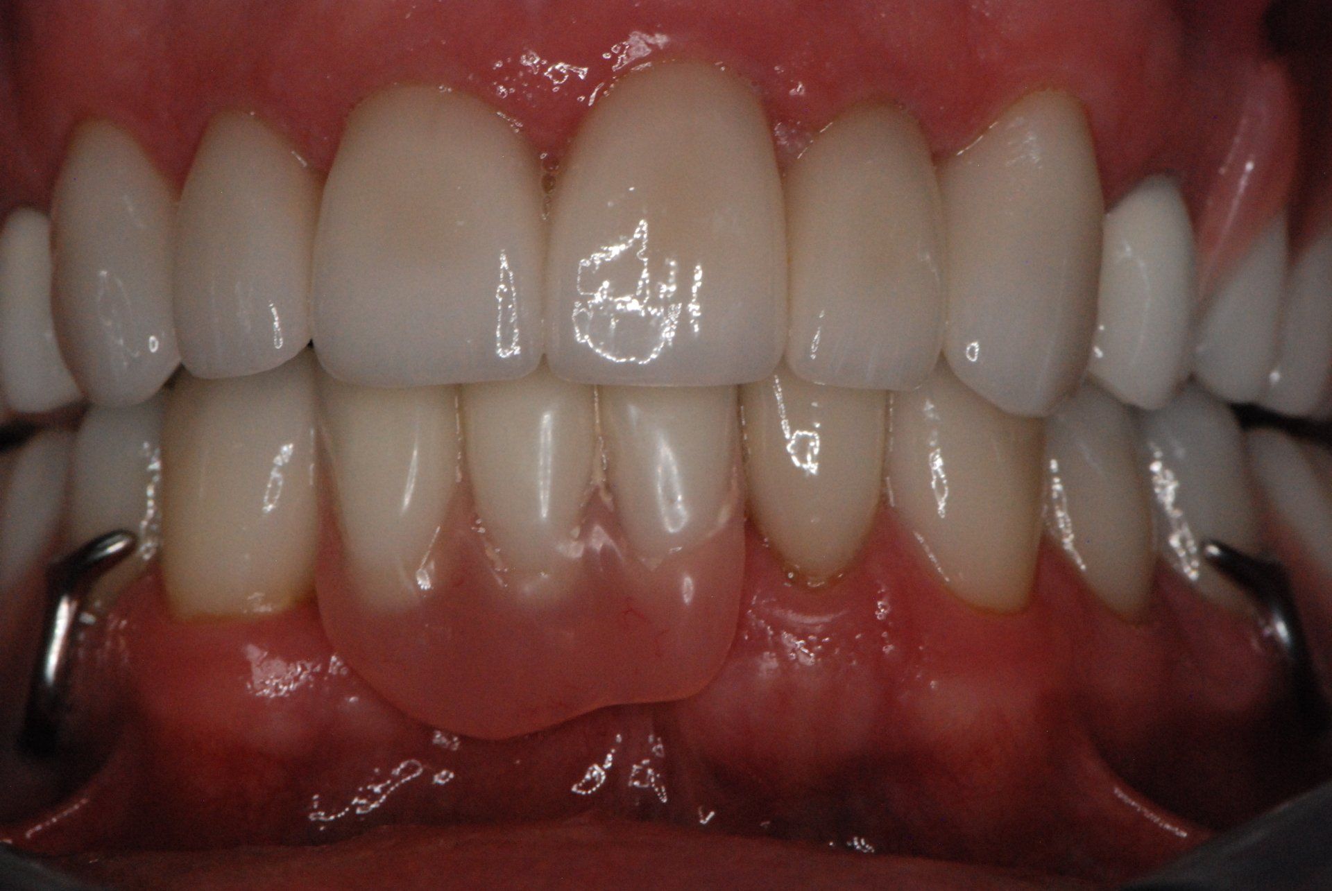 Silverstone Family Dental Meridian, ID
