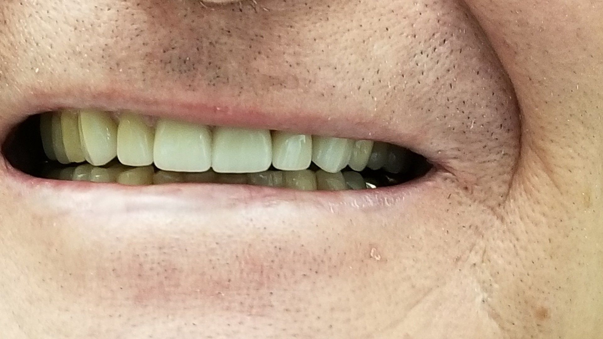 Silverstone Family Dental Meridian, ID