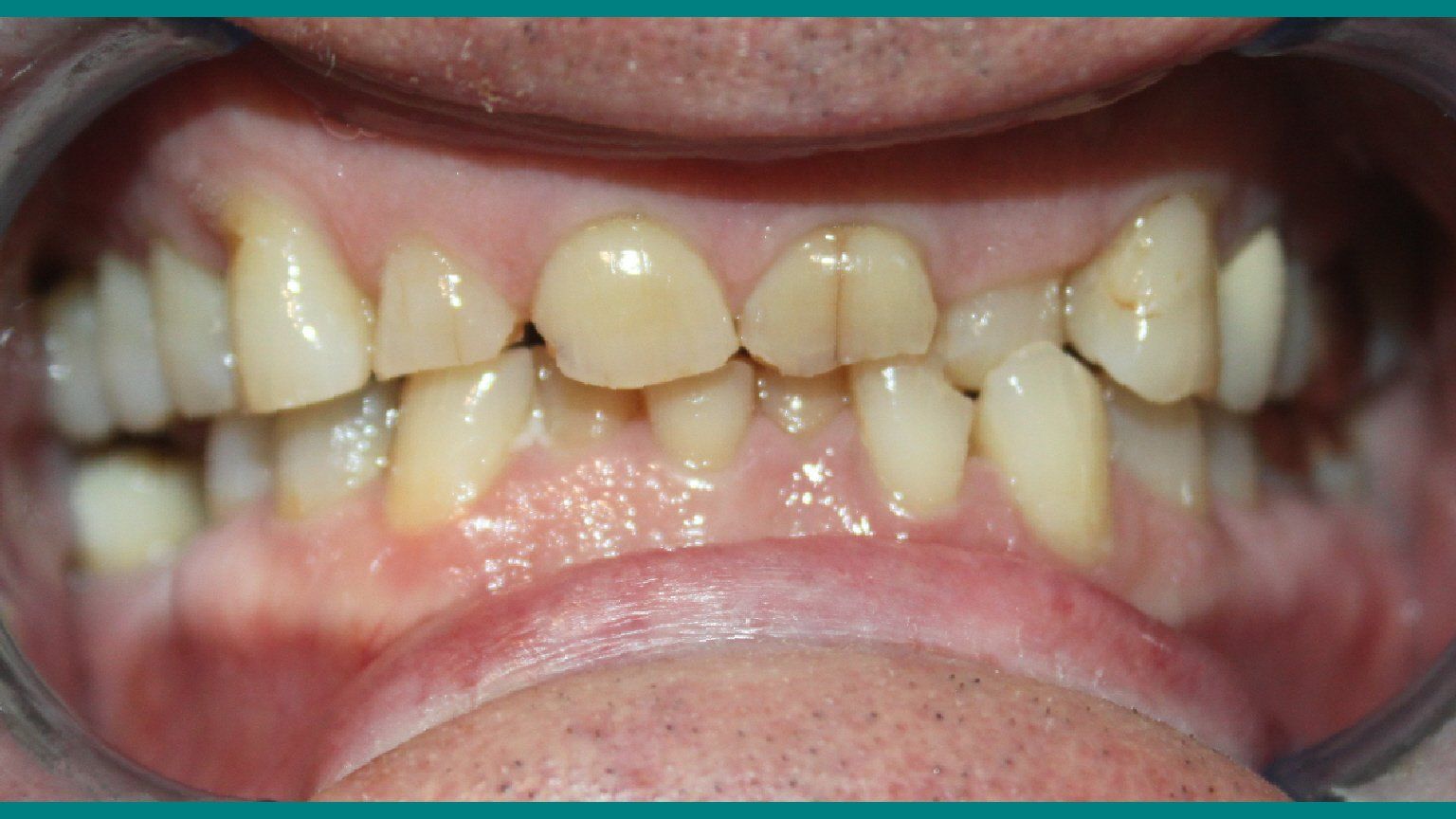 Silverstone Family Dental Meridian, ID
