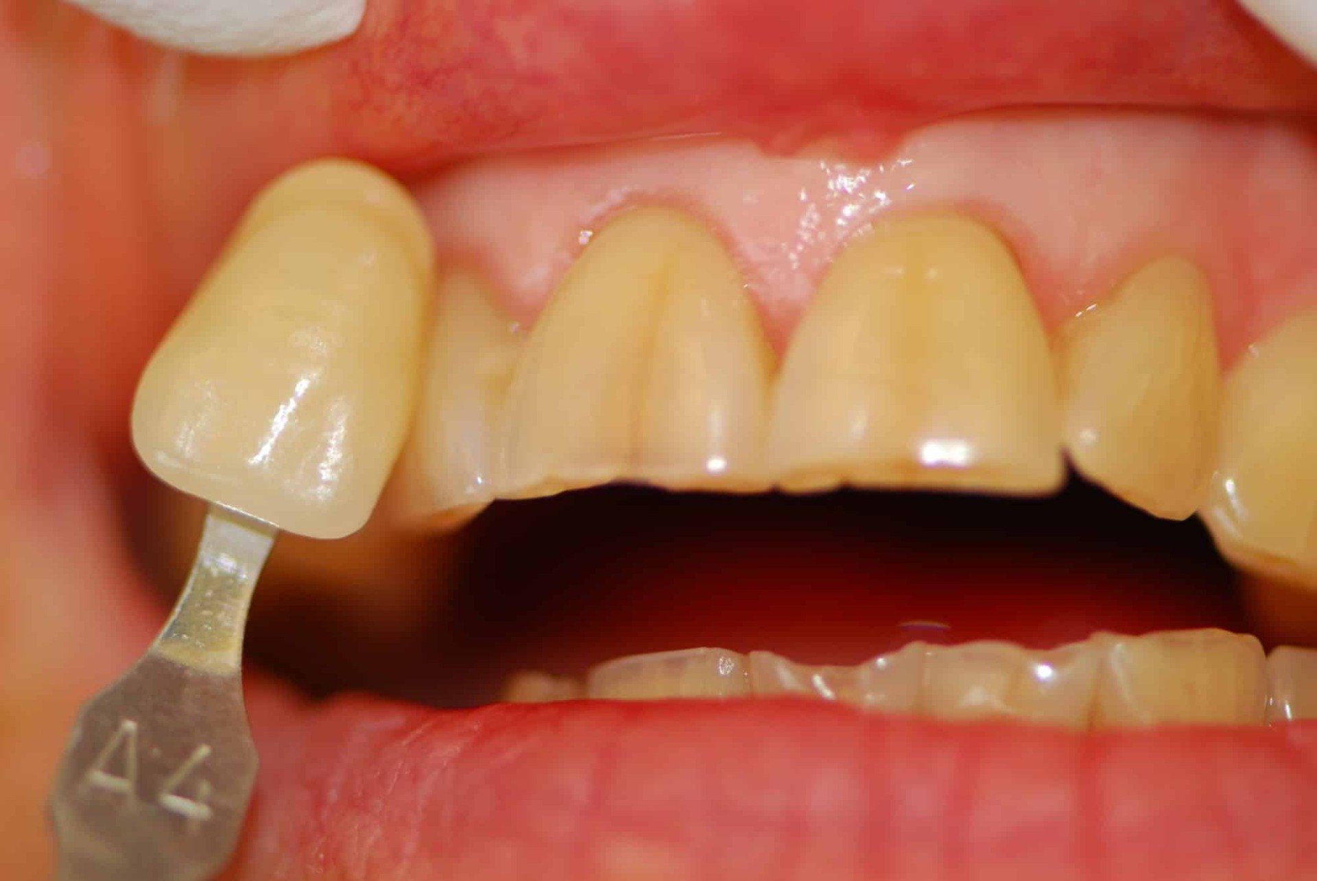 Silverstone Family Dental Meridian, ID
