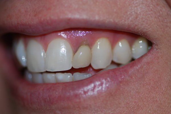 Silverstone Family Dental Meridian, ID