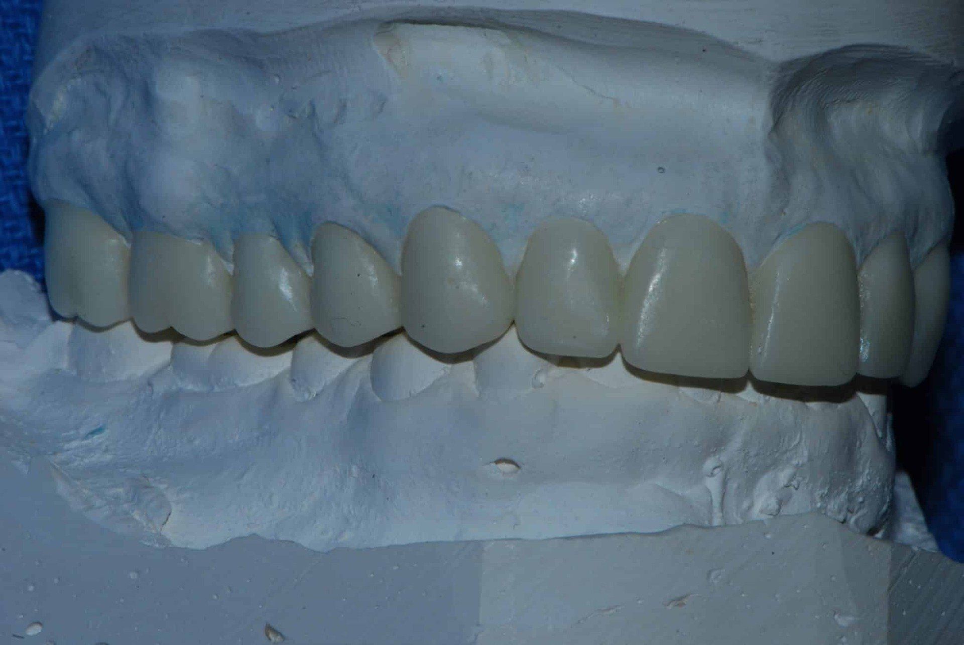 Silverstone Family Dental Meridian, ID