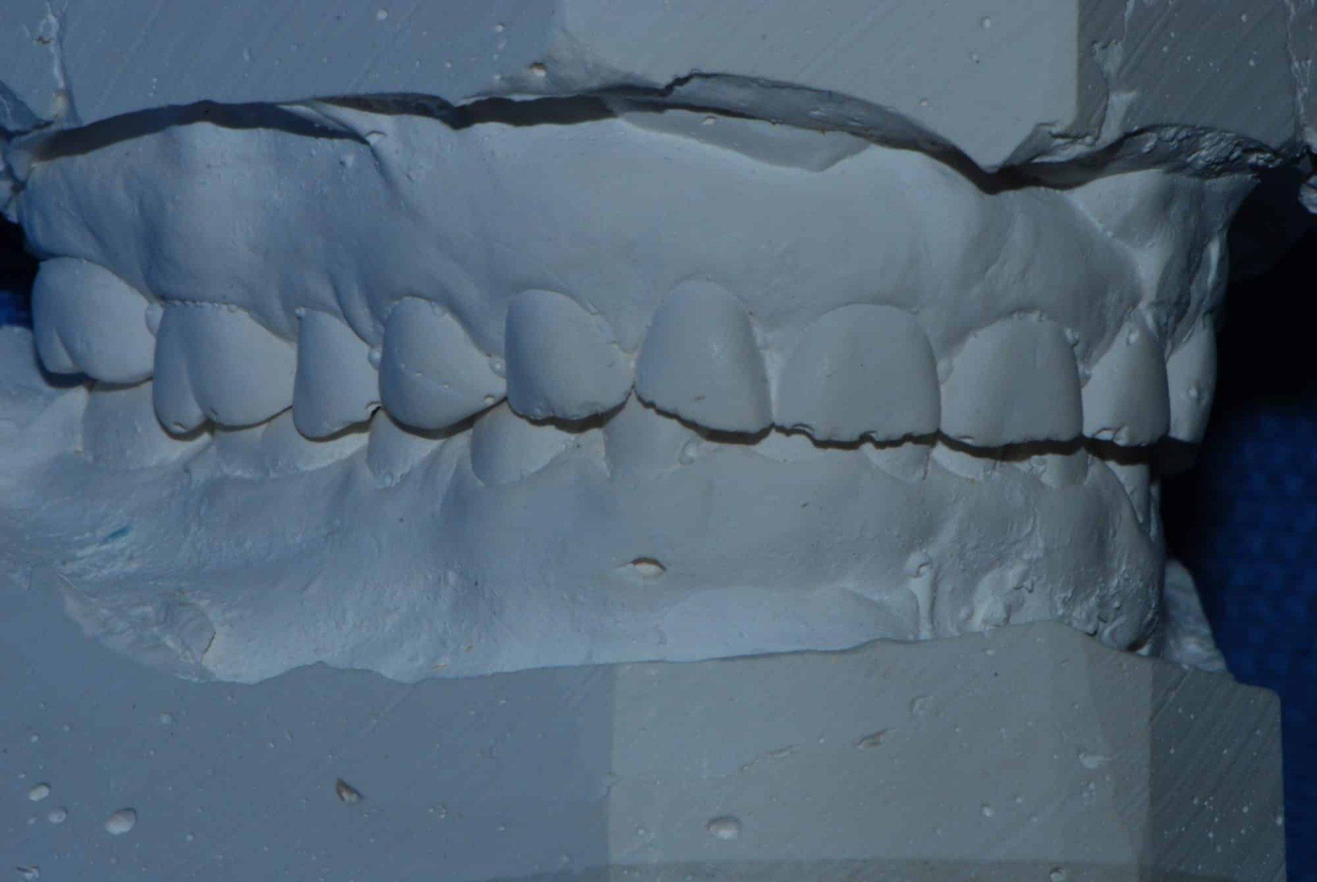 Silverstone Family Dental Meridian, ID