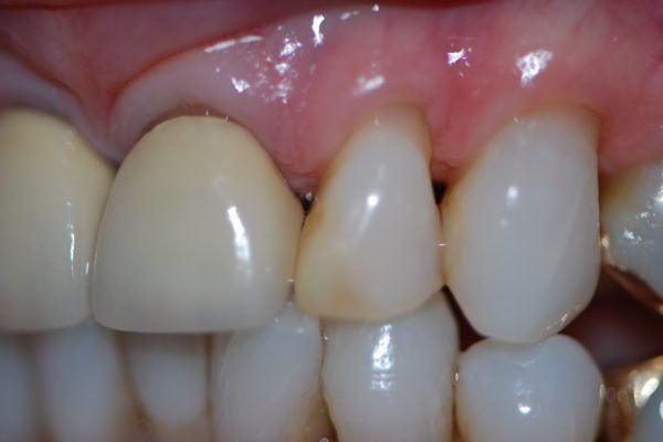 Silverstone Family Dental Meridian, ID