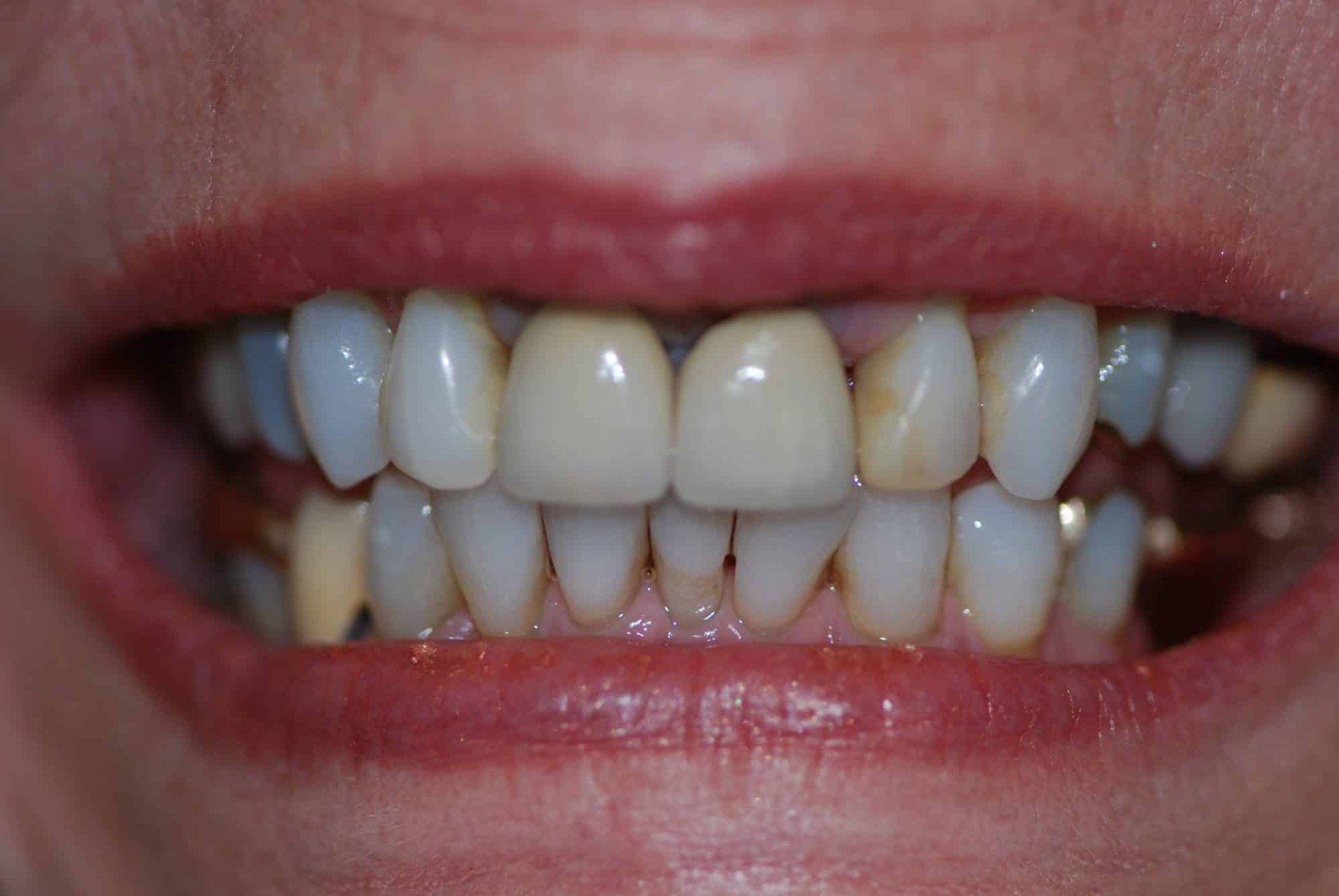 Silverstone Family Dental Meridian, ID
