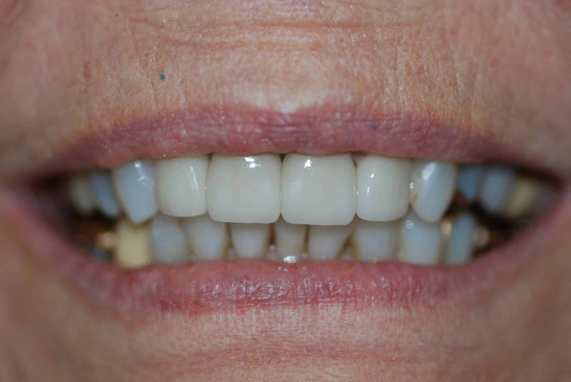 Silverstone Family Dental Meridian, ID