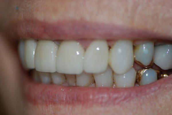 Silverstone Family Dental Meridian, ID