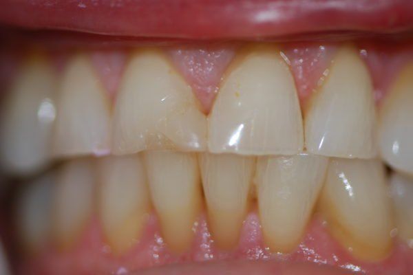 Silverstone Family Dental Meridian, ID