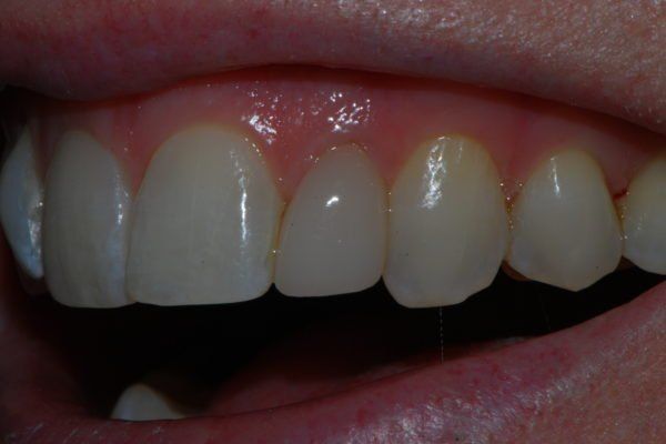Silverstone Family Dental Meridian, ID