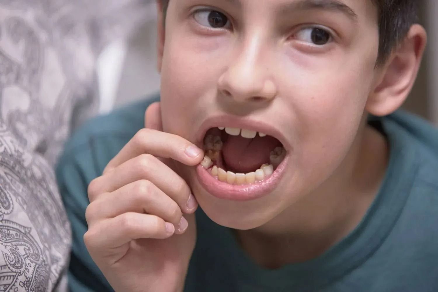 Child looking at a loose tooth while touching their mouth, with a tissue-patterned background