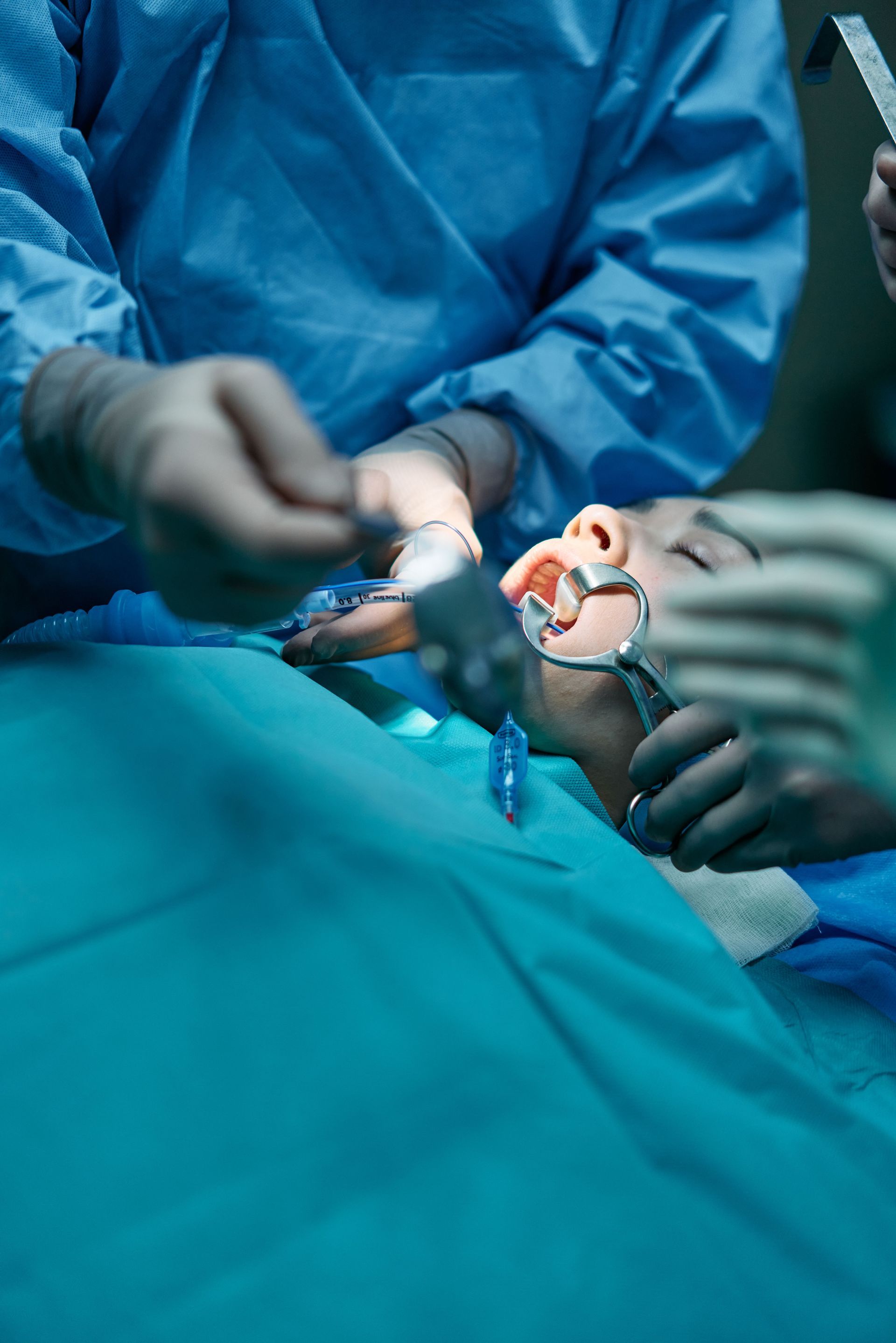 Surgeons performing an operation on a patient under blue surgical drapes, with gloved hands and medical tools visible