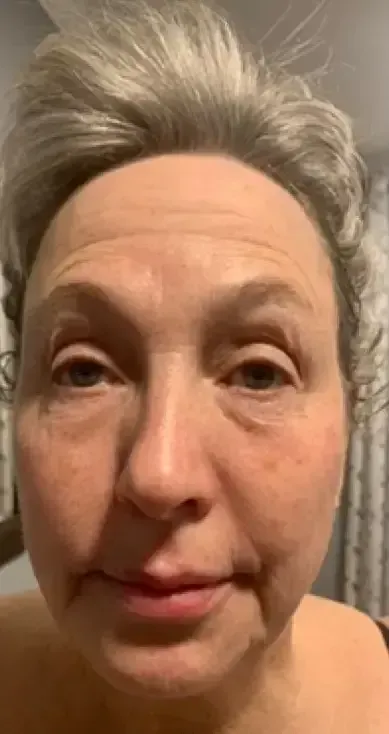 Close-up selfie of a person with gray hair and a neutral expression against a plain background