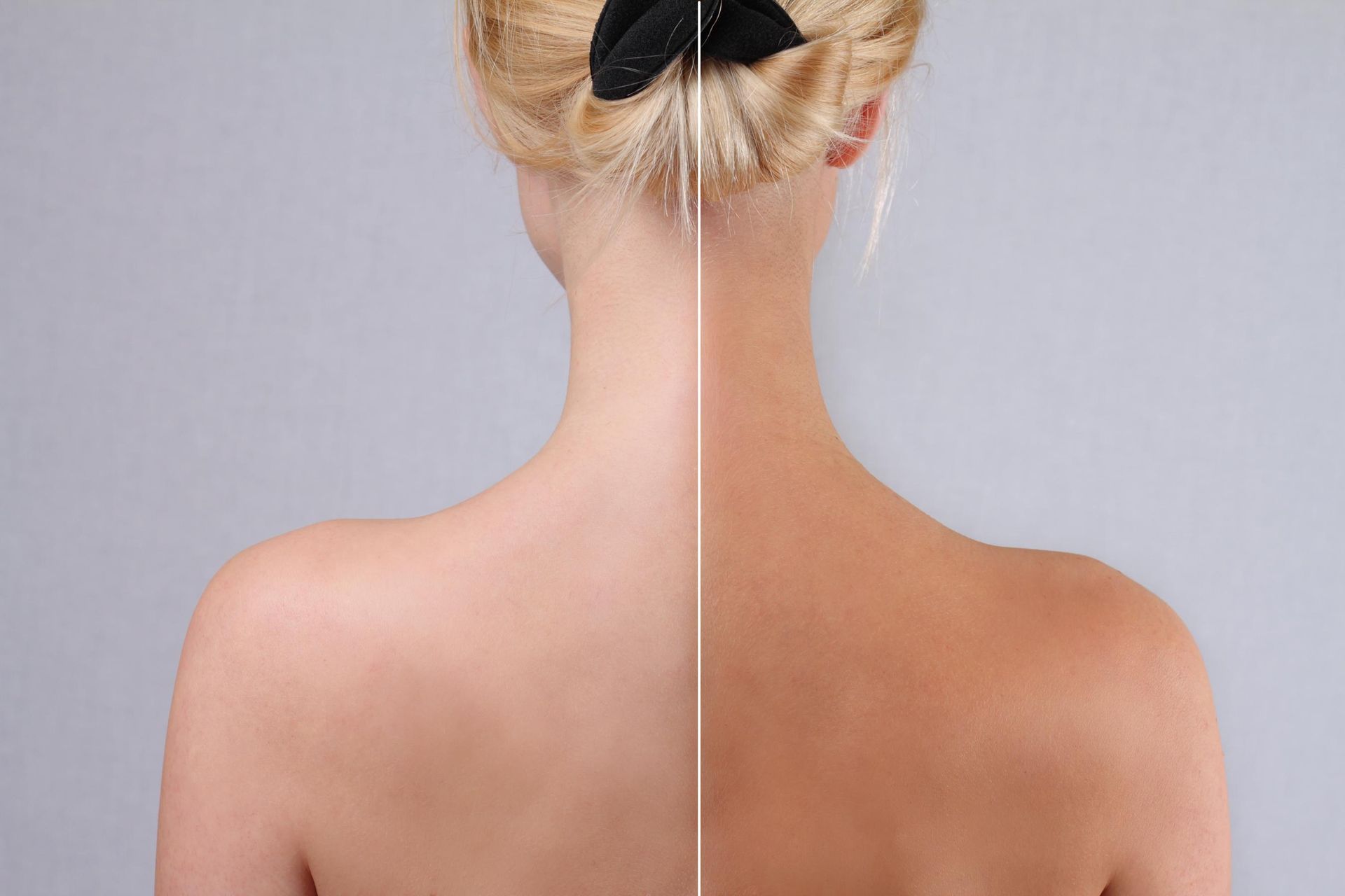 Back view of a woman with a straight vertical line marking spinal alignment on her back