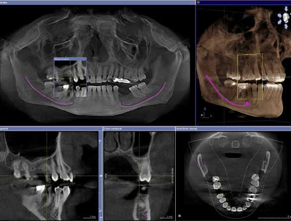 radiologia 3d