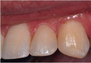 estetica dentale