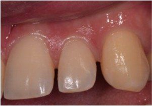 estetica dentale