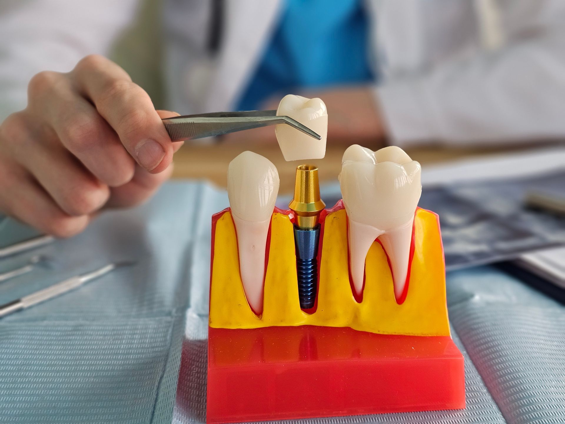 Dental implant model with toothbrush and floss tool demonstrating oral hygiene