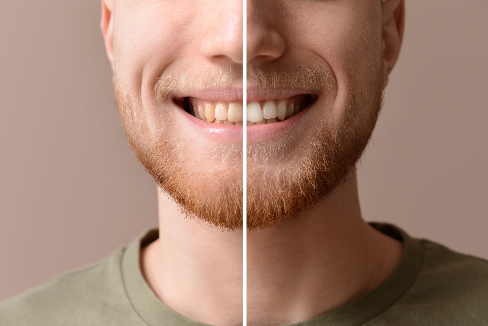 Split close-up of a smiling face with beard, shown half bare and half with a green shirt