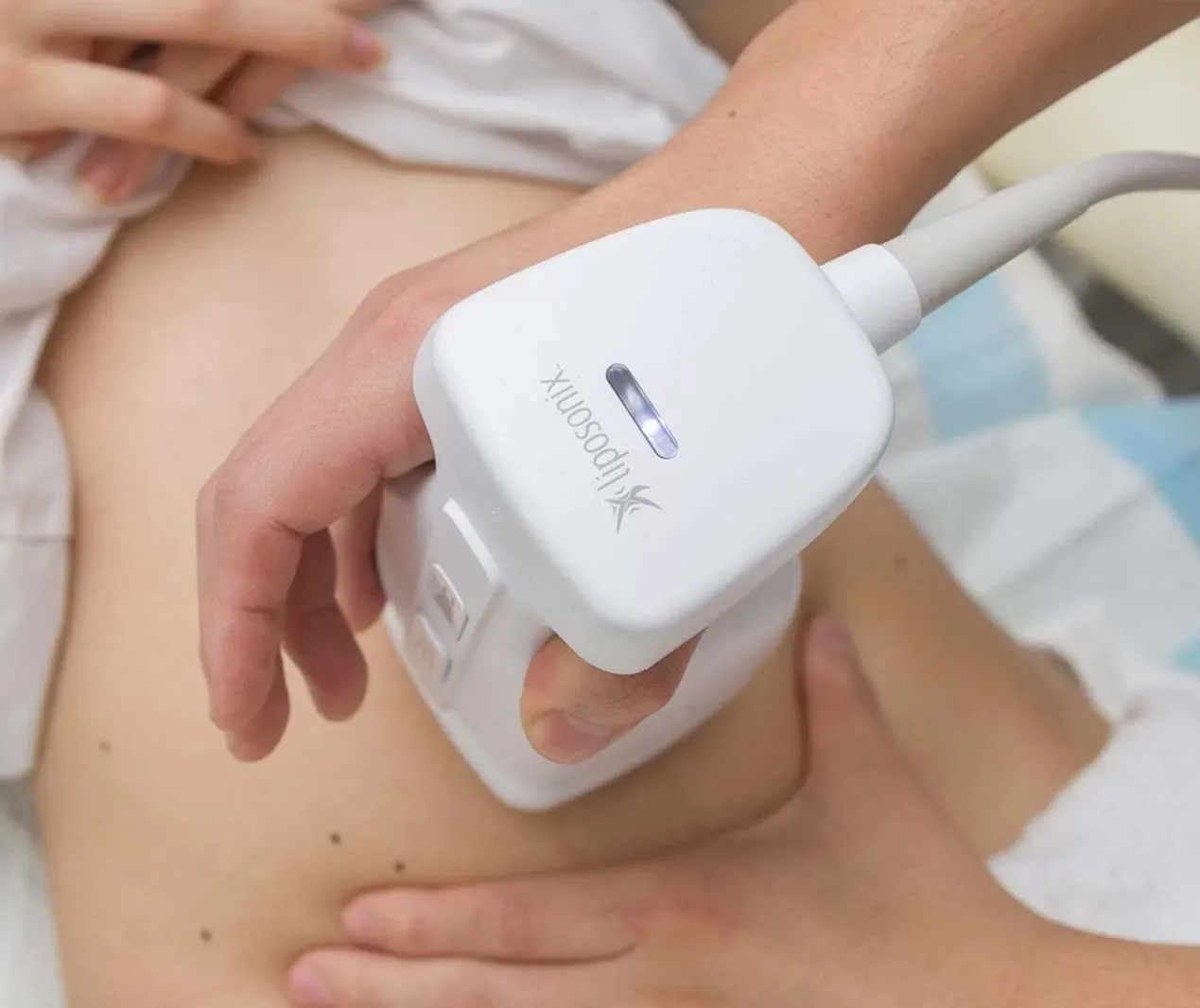 Liposonix Treatment