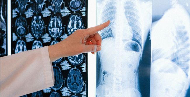 Ortopedia y traumatología